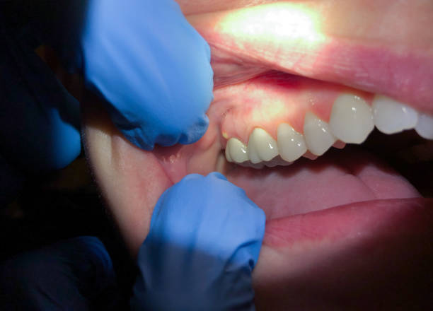 Best Orthodontic Emergency Dentist in Inglenook, CT